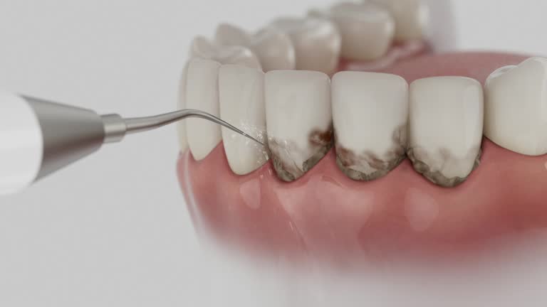 Trusted Teeth Cleaning And Checkup service in South San Gabriel, CA - Dentist Open Now